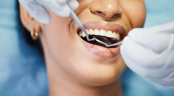 Best Emergency Tooth Extraction in Kiefer, OK