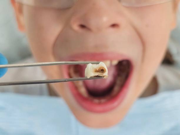 Best After-Hours Emergency Dentist in Kiefer, OK