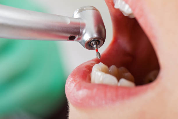 Best Emergency Treatment for Toothache in Kiefer, OK